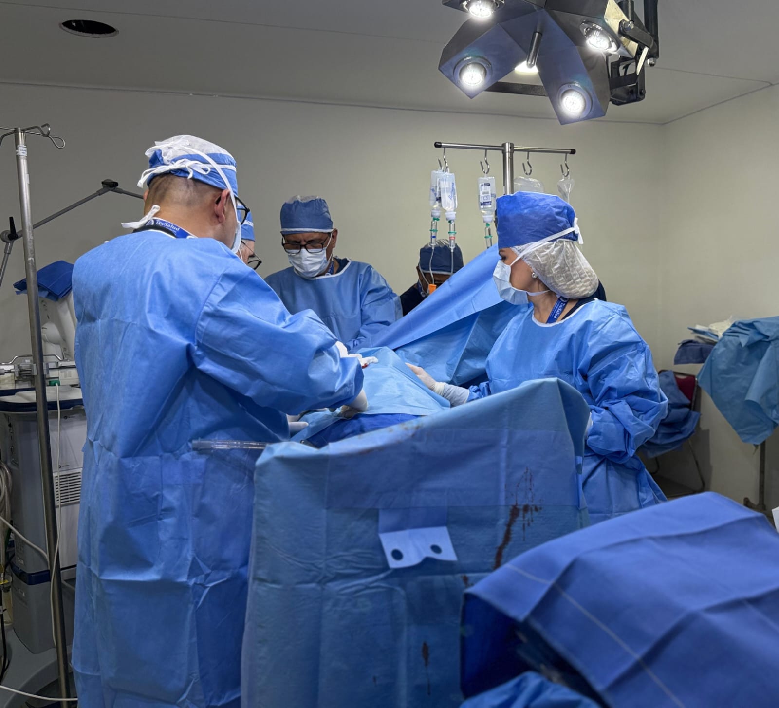 ECMO