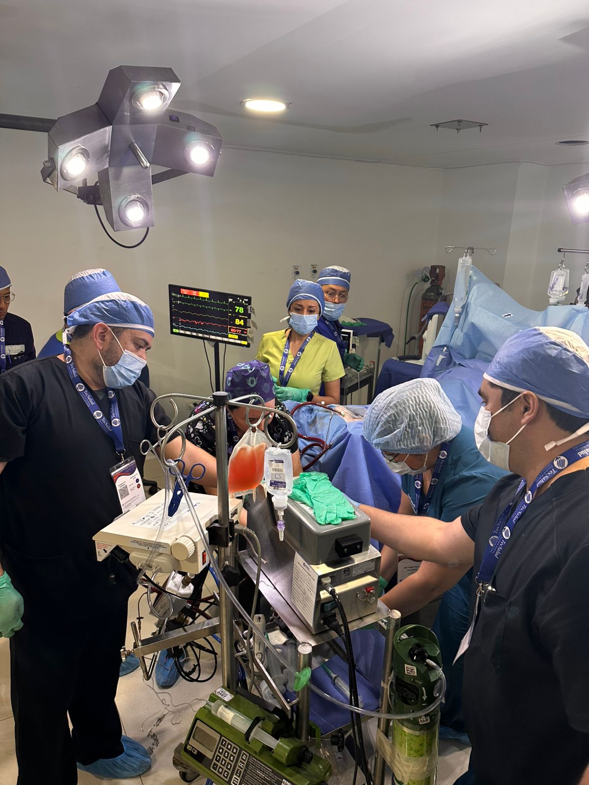 ECMO