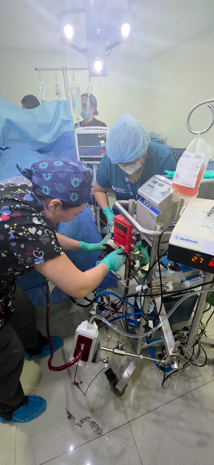 ECMO