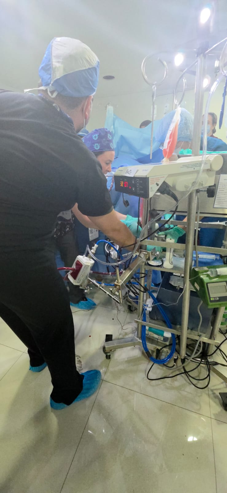 ECMO