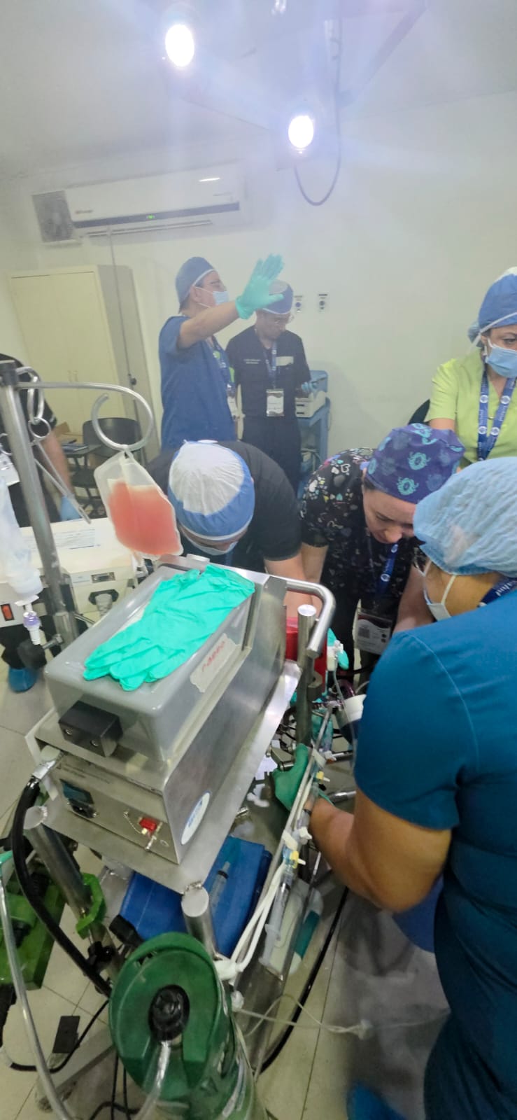 ECMO