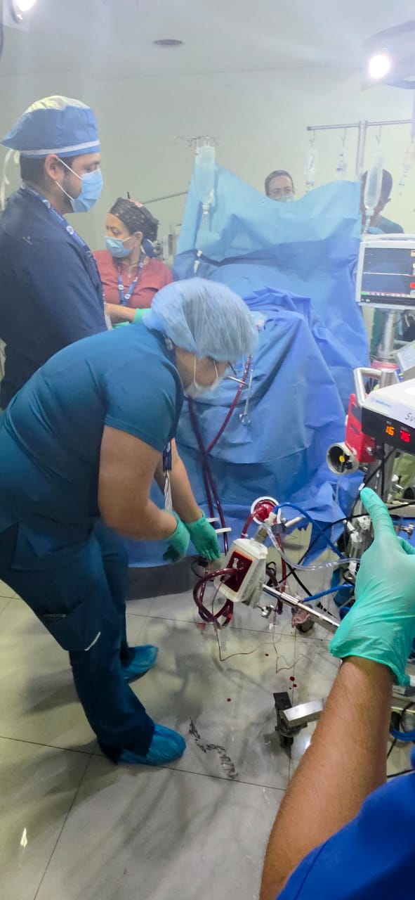 ECMO