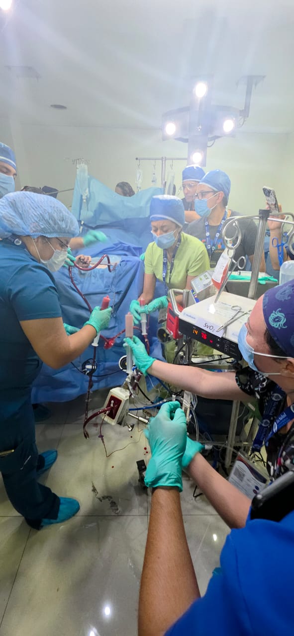 ECMO
